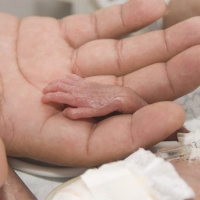 Bebê prematuro – 12 dicas para lidar com a situação